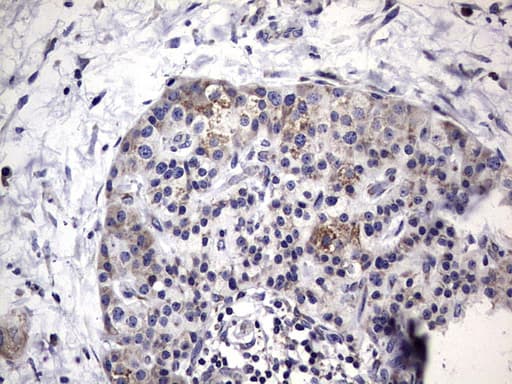 MTDH / Metadherin Antibody (aa70-582, clone OTI1B6)