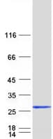 Human CPLX3 Protein (Recombinant Myc-DDK (Flag))