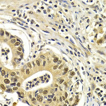 CDK7 Antibody