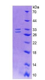 Human NGF Protein (Recombinant His, N-Terminal)
