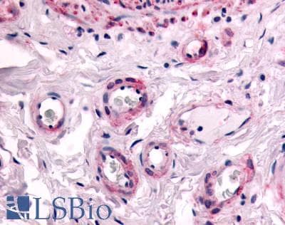 PathPlus™ Polyclonal Rabbit anti-Human PTPRE / PTP Epsilon Antibody (Cytoplasmic Domain, IHC)
