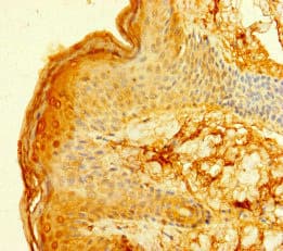 Polyclonal Rabbit anti-Human FcERI / Fc Epsilon RI Antibody (IHC, IF, WB)