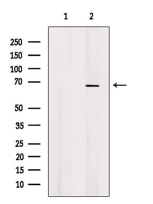 CTP Synthetase 2 / CTPS2 Antibody