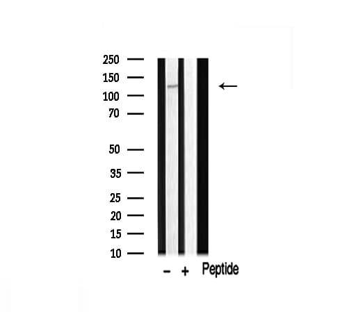 FARP2 / FRG Antibody