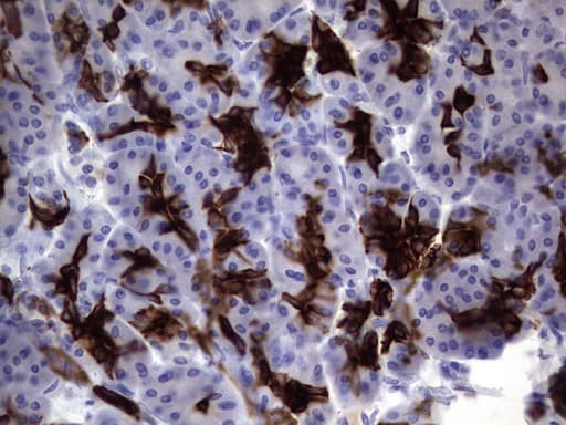 KRT19 / CK19 / Cytokeratin 19 Antibody (aa240-390, clone OTI7H7)