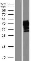 AMMECR1 Protein (Over-Expression Lysate Myc-DDK (Flag))