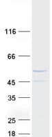 Human CCNJL Protein (Recombinant Myc-DDK (Flag))