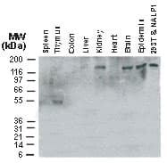 NALP1 / NLRP1 Antibody (aa161-180)