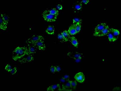 SELP / P-Selectin / CD62P Antibody