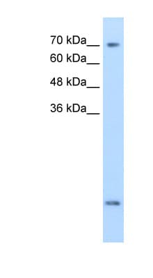 SLC6A8 Antibody (aa200-249, FITC)