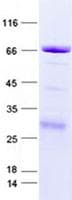 Human RPL6 / Ribosomal Protein L6 (Recombinant GST, N-terminus + His, C-terminus)