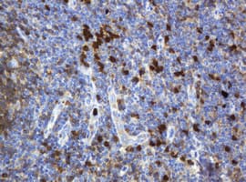 c-Kit / CD117 Antibody (aa546-976, clone 9A11, Carrier-free)