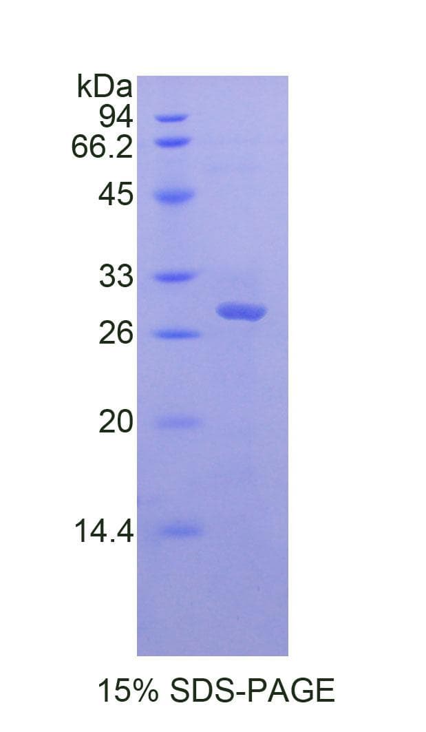 Mouse MYD88 Protein (Recombinant His)
