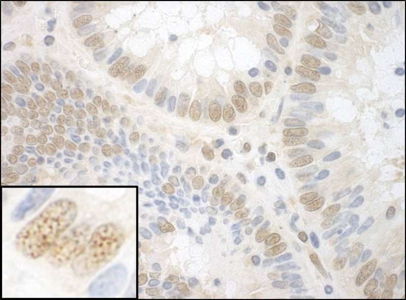 Polyclonal Rabbit anti-Human NPAT Antibody (aa1377-1427, IHC, WB)