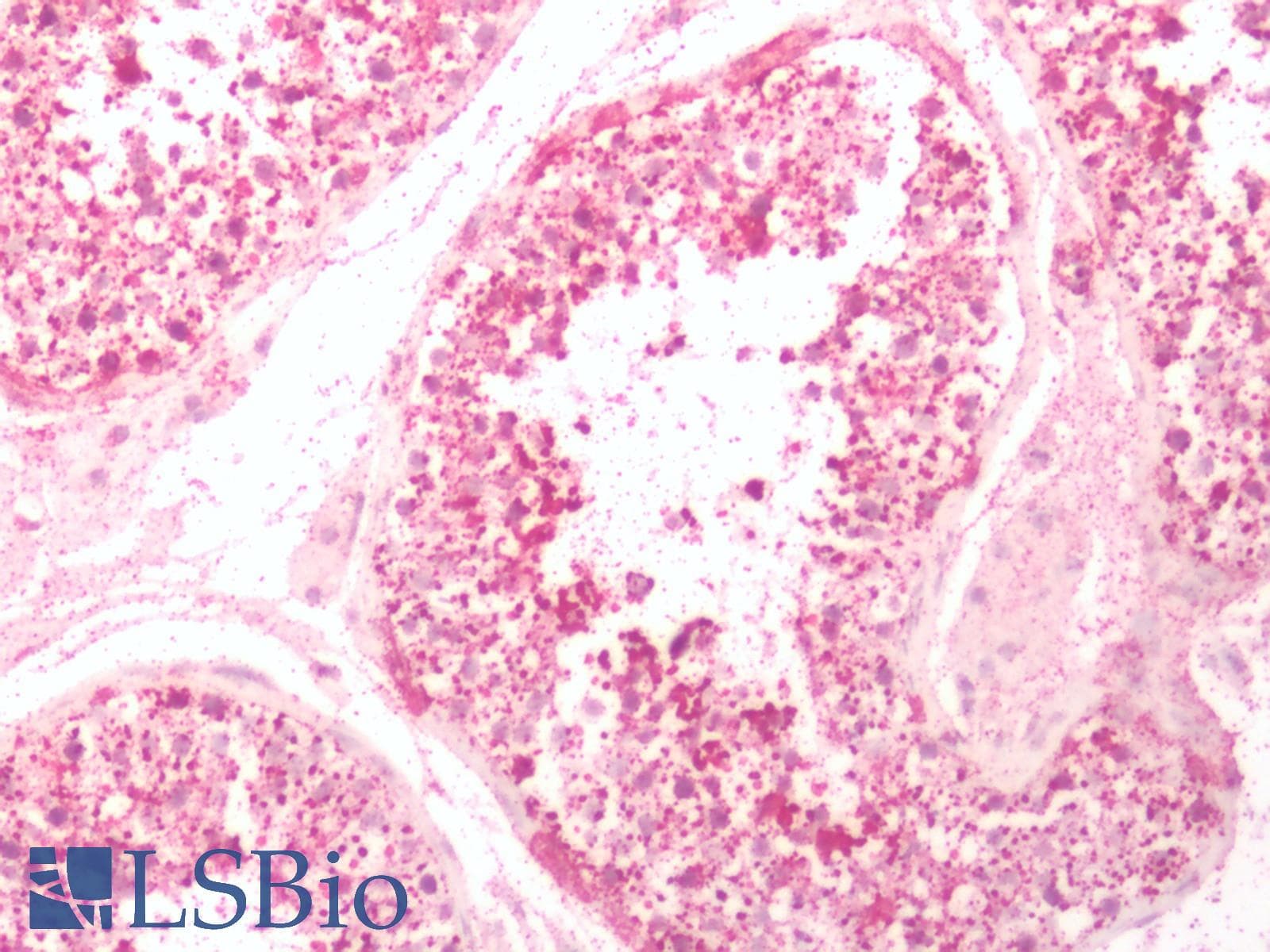 IHC-plus™ Polyclonal Rabbit anti-Human NMUR2 Antibody (N-Terminus, IHC)