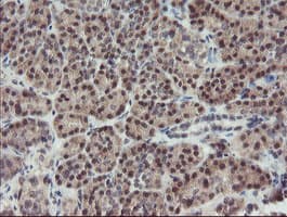 Monoclonal Mouse anti-Human DPH2 Antibody (clone OTI1A12, IHC, WB)