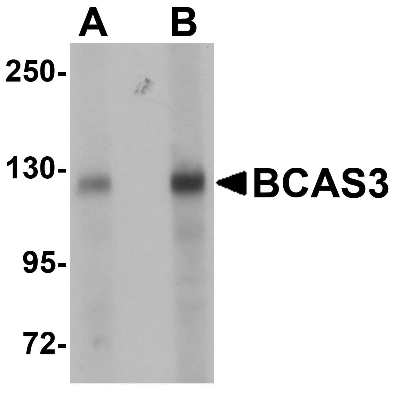 IHC-plus™ Polyclonal Rabbit anti-Human BCAS3 Antibody (IHC, IF, WB)
