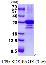 Human DTD1 Protein (Recombinant His)