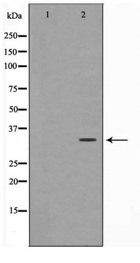 Polyclonal Rabbit anti-Human MAGEA1 / MAGE 1 Antibody (IHC, WB)