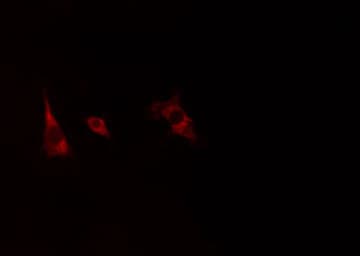 CYP19 / Aromatase Antibody