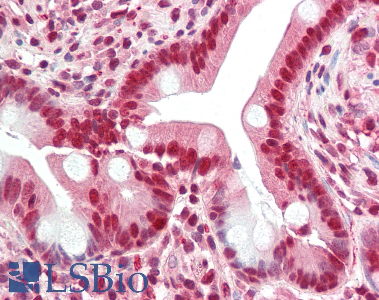 IHC-plus™ Polyclonal Rabbit anti-Human GHDC Antibody (IHC, IF, WB)