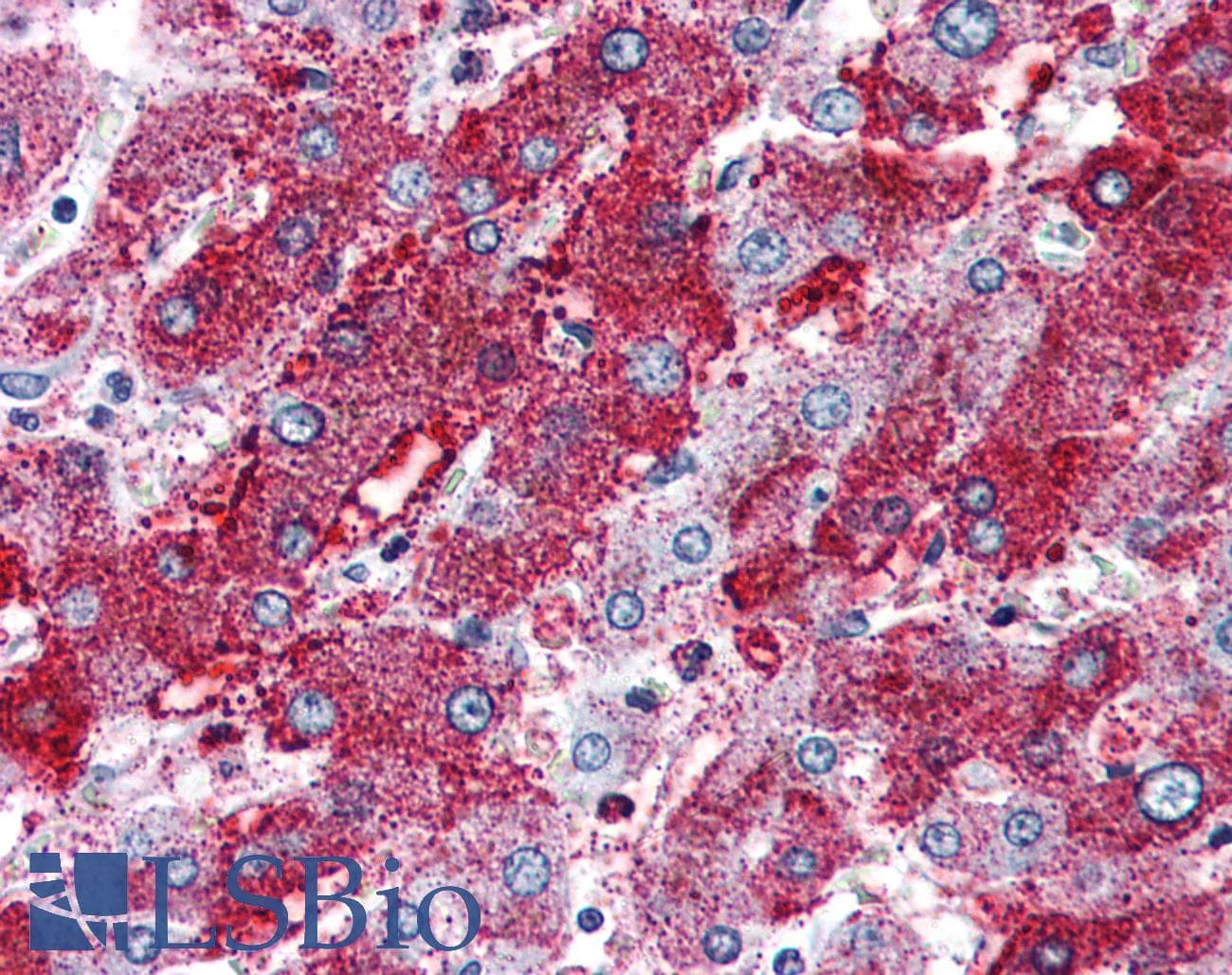 IHC-plus™ PACE4 / PCSK6 Antibody (Internal)