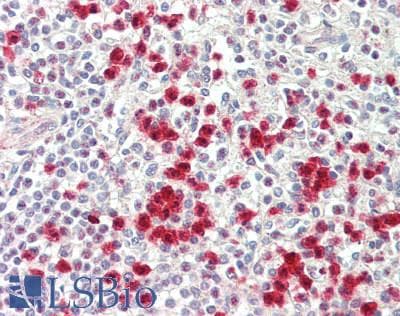 Polyclonal Rabbit anti-Human FPR1 / FPR Antibody (130-210 aa, Internal, IHC, IF, WB)