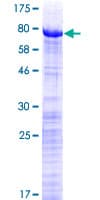Human PRPF31 Protein (Recombinant GST)