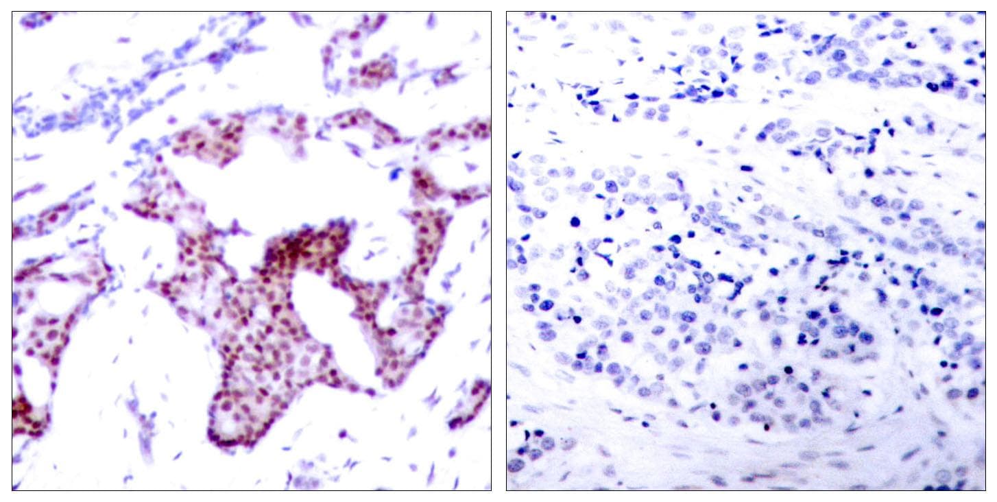 RELA / NFKB p65 Antibody (phospho-Ser276)