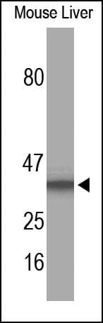 CD68 Antibody