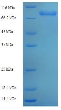Human POLG2 Protein (Recombinant His-SUMO)