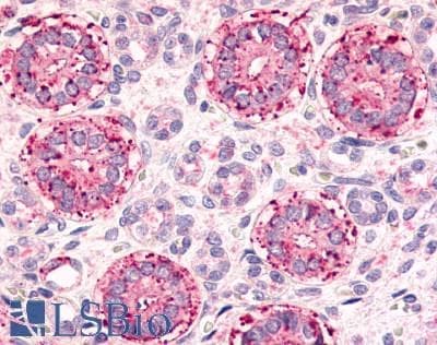 IHC-plus™ Polyclonal Rabbit anti-Human FZD2 / Frizzled 2 Antibody (N-Terminus, IHC)