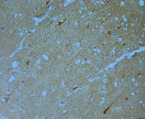 Polyclonal Rabbit anti-Human MPP1 Antibody (aa410-460, IHC)