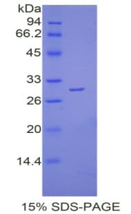 Mouse LY9 / CD229 Protein (Recombinant His)