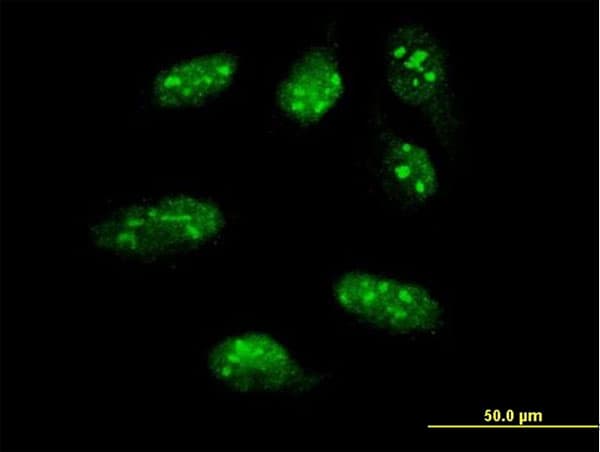 LHX1 Antibody (clone 4D1)
