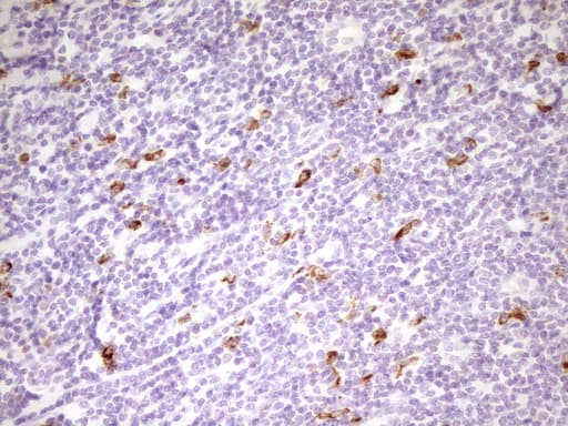 APOBR / APOB48R Antibody (aa780-1088, clone OTI1B1, Carrier-free)