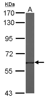 TROVE2 Antibody (aa178-459)