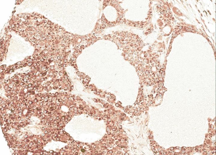AGT / Angiotensinogen Antibody (aa1-476)