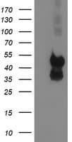 PDSS2 / DLP1 Antibody (clone OTI4F9)
