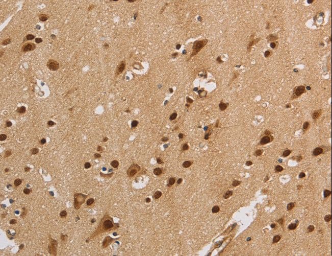 Polyclonal Rabbit anti-Human KV6.4 / KCNG4 Antibody (IHC, WB)