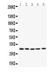 BCL2L1 / BCL-XL Antibody