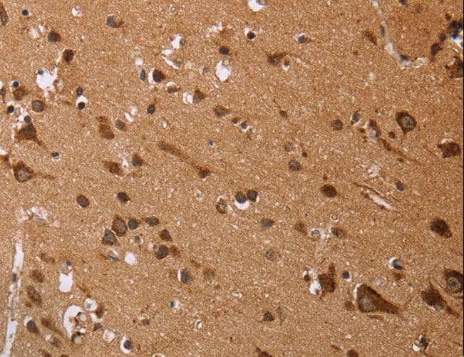 Endothelin 3 / EDN3 Antibody