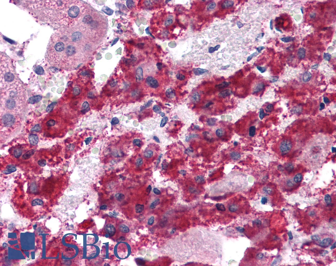 IHC-plus™ LYRM2 Antibody