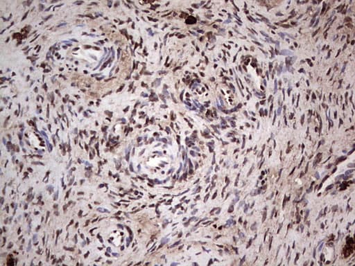 Monoclonal Mouse anti-Human SAE1 Antibody (clone OTI6B11, IHC, WB)
