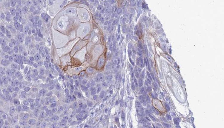RGS21 Antibody