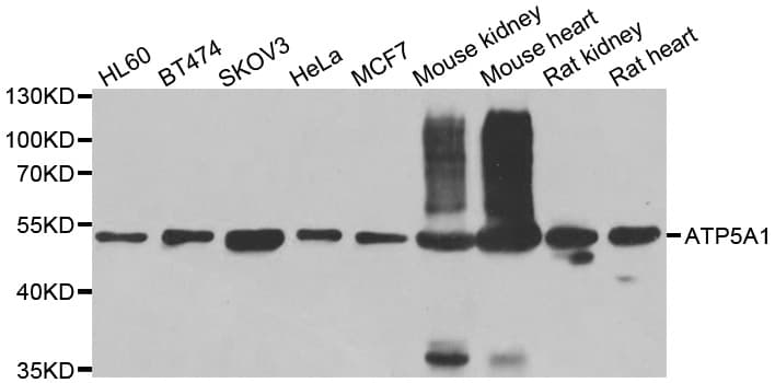 IHC-plus™ Polyclonal Rabbit anti-Human ATP5A1 / ATP Synthase Alpha Antibody (IHC, IF, WB)