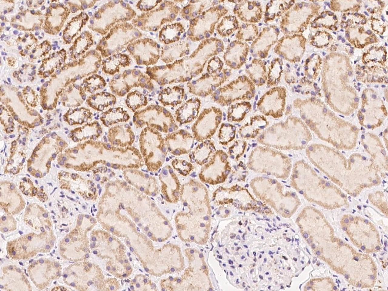 DLEC1 / DLC1 Antibody