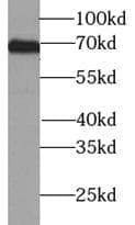 Polyclonal Rabbit anti-Human Tyrosinase Antibody (IHC, IF, WB)