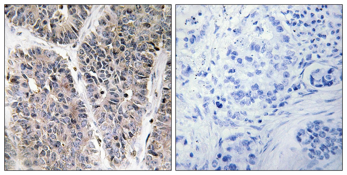 NBL1 / DAN Antibody