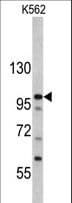 Polyclonal Rabbit anti-Human MTBP / Mdm2-Binding Protein Antibody (aa853-881, IHC, WB)
